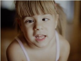 Can Strabismus Lead to Learning Issues in Children?