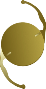 Toric IOL