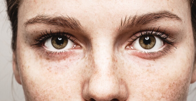 What is Dry Eye Treatment?