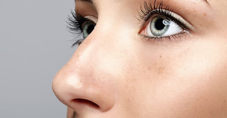 What is Pterygium Treatment?